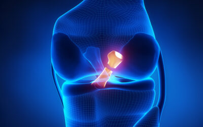 LCA: quando posso tornare a giocare?