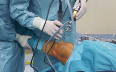 Artroscopia per il menisco: ha senso dopo i 40-45 anni?